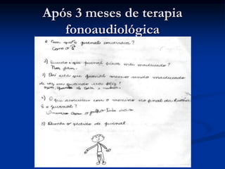 Após 3 meses de terapia
fonoaudiológica
 
