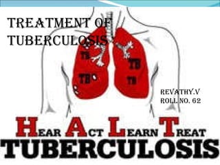 TREATMENT OF TUBERCULOSIS TREATMENT OF TUBERCULOSIS REVATHY.V ROLL NO. 62 