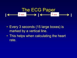 4- ECG.ppt
