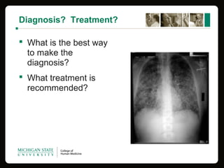 Diagnosis? Treatment?
 What is the best way 
to make the 
diagnosis?
 What treatment is 
recommended?
 