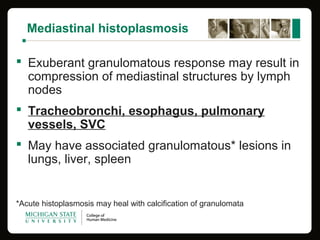 Mediastinal histoplasmosis
 Exuberant granulomatous response may result in
compression of mediastinal structures by lymph
nodes
 Tracheobronchi, esophagus, pulmonary
vessels, SVC
 May have associated granulomatous* lesions in
lungs, liver, spleen
*Acute histoplasmosis may heal with calcification of granulomata
 