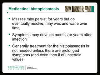 Mediastinal histoplasmosis
 Masses may persist for years but do
eventually resolve; may wax and wane over
time
 Symptoms may develop months or years after
infection
 Generally treatment for the histoplasmosis is
not needed unless there are prolonged
symptoms (and even then if of uncertain
value)
 