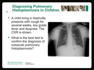 Diagnosing Pulmonary
Histoplasmosis in Children
 A child living in Nashville
presents with cough for
several weeks, low grade
fever and dyspnea. The
CXR is shown.
 What is the best test to
confirm the diagnosis of
subacute pulmonary
histoplasmosis?
 