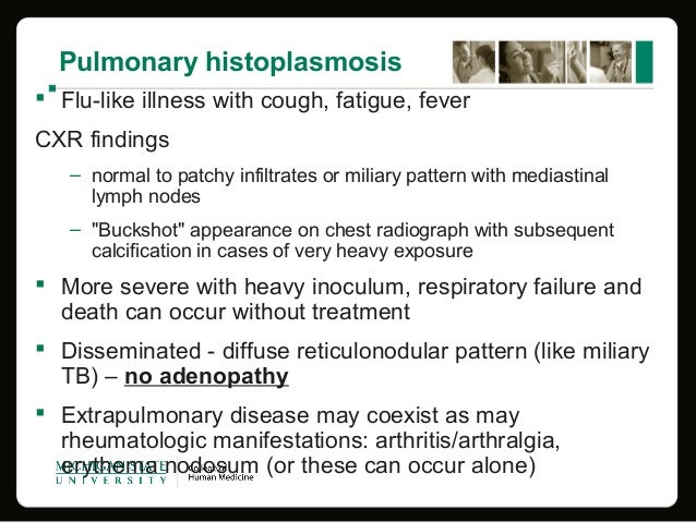 Overview Of Histoplasmosis