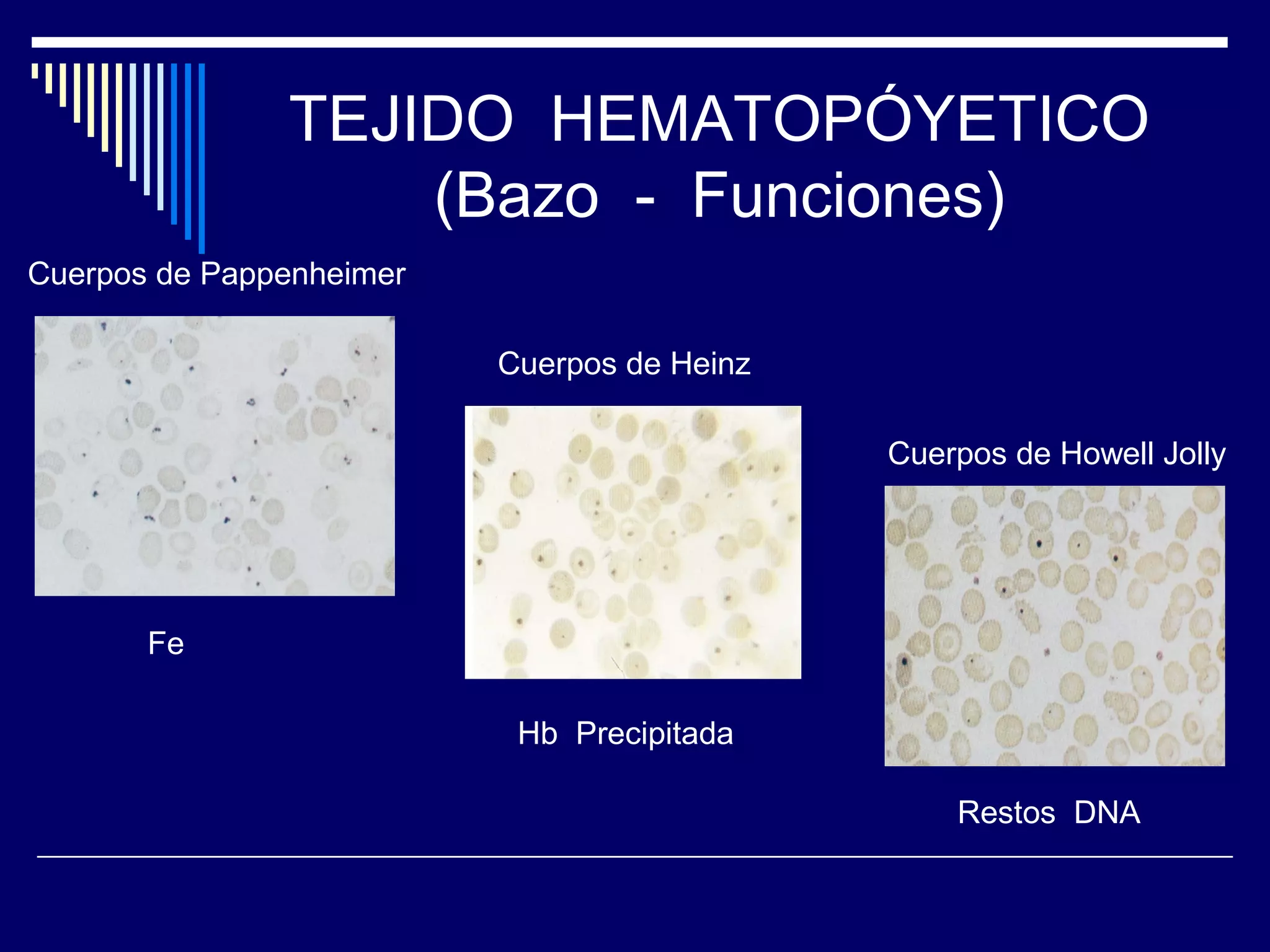 TEJIDO HEMATOPÓYETICO
                   (Bazo - Funciones)
Cuerpos de Pappenheimer

                          Cuerpos de Heinz

                                             Cuerpos de Howell Jolly




       Fe

                           Hb Precipitada

                                                 Restos DNA
 