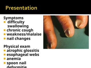 Symptoms
◾ difficulty
swallowing
◾ chronic cough
◾ weakness/malaise
◾ nail changes
Physical exam
◾ atrophic glossitis
◾ esophageal webs
◾ anemia
◾ spoon nail
 