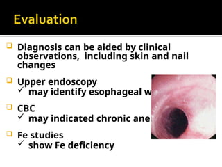  Diagnosis can be aided by clinical
observations, including skin and nail
changes
 Upper endoscopy
 may identify esophageal webs
 CBC
 may indicated chronic anemia
 Fe studies
 show Fe deficiency
 