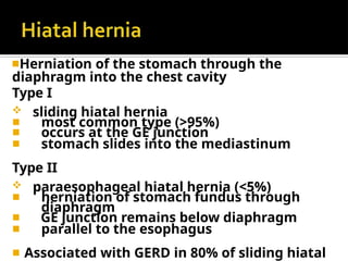 ◾Herniation of the stomach through the
diaphragm into the chest cavity
Type I
 sliding hiatal hernia
◾ most common type (>95%)
◾ occurs at the GE junction
◾ stomach slides into the mediastinum
Type II
 paraesophageal hiatal hernia (<5%)
◾ herniation of stomach fundus through
diaphragm
◾ GE junction remains below diaphragm
◾ parallel to the esophagus
◾ Associated with GERD in 80% of sliding hiatal
 