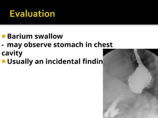 ◾ Barium swallow
- may observe stomach in chest
cavity
◾ Usually an incidental finding
 