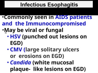 Infectious Esophagitis
•Commonly seen in AIDS patients
and the Immunocompromised
•May be viral or fungal
• HSV (punched out lesions on
EGD)
• CMV (large solitary ulcers
or erosions on EGD)
• Candida (white mucosal
plaque- like lesions on EGD)
 