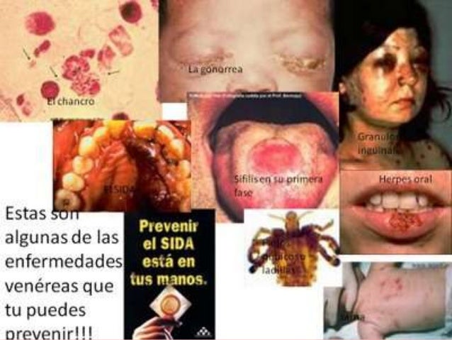 Imagen relacionada