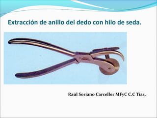 Extracción de anillo del dedo con hilo de seda.
Raúl Soriano Carceller MFyC C.C Tías.
 