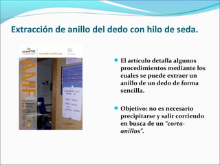 Extracción de anillo del dedo con hilo de seda.
El artículo detalla algunos
procedimientos mediante los
cuales se puede extraer un
anillo de un dedo de forma
sencilla.
Objetivo: no es necesario
precipitarse y salir corriendo
en busca de un “corta-
anillos”.
 