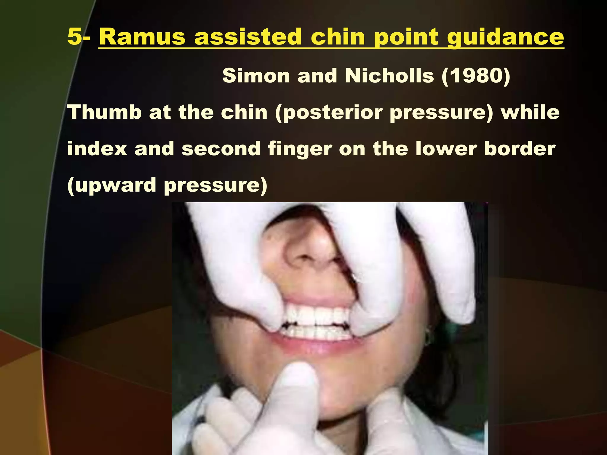 Clinical Steps for Complete Denture Construction 4 Steps of recording jaw relation E Centric