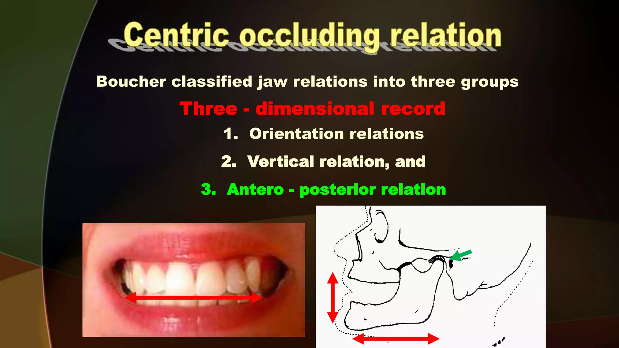 Complete Denture 4 Maxillomandibular Relation Records d Centric
