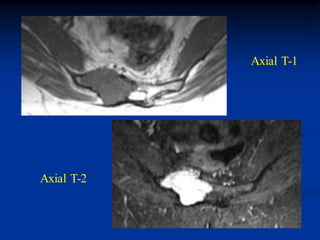 Axial T-1




Axial T-2
 