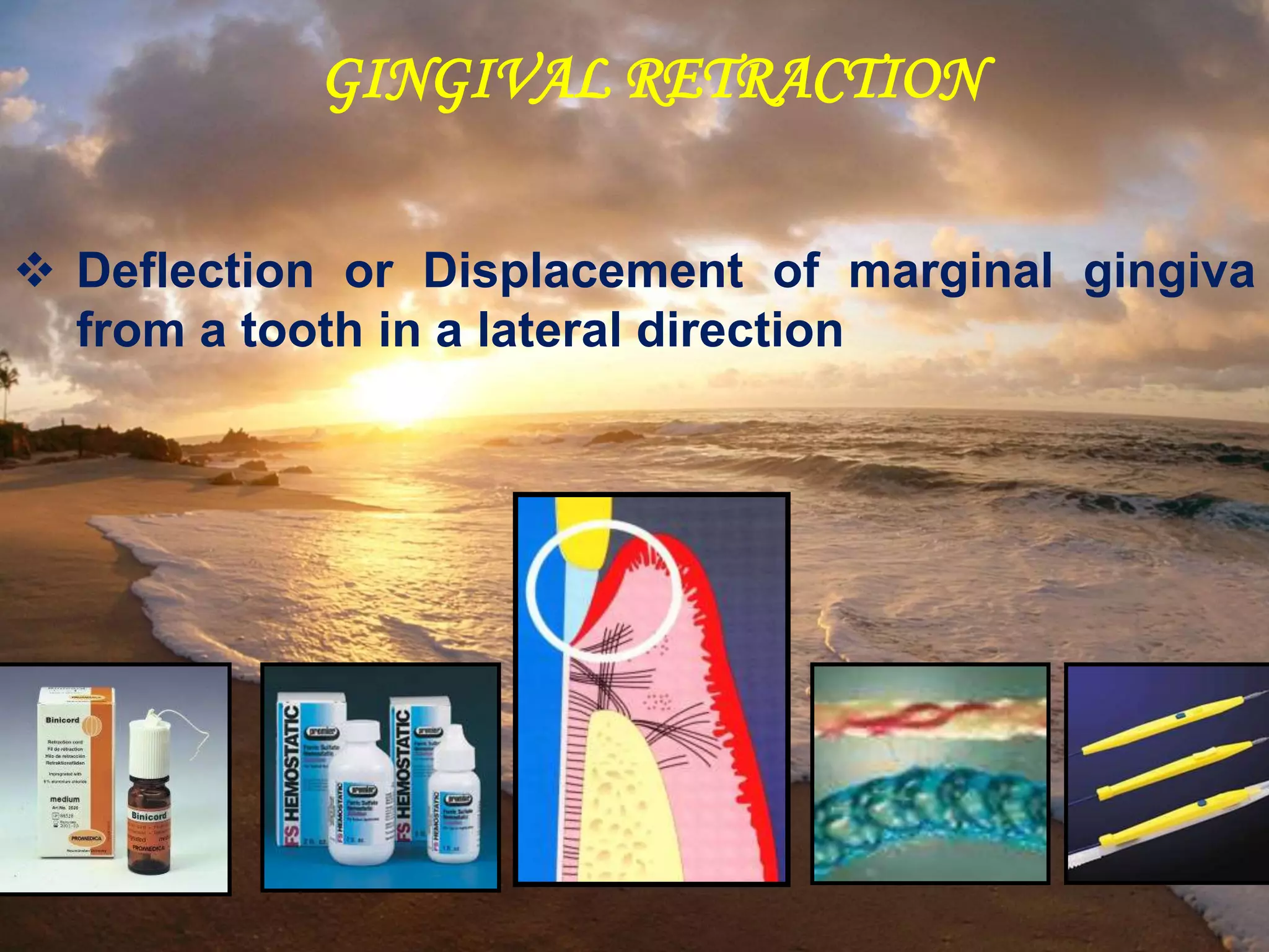 4 Gingival Retraction & Impressions.ppt