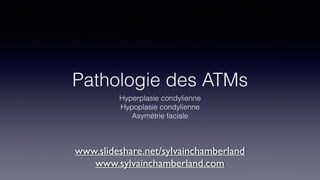 Pathologie des ATMs
Hyperplasie condylienne
Hypoplasie condylienne
Asymétrie faciale
www.slideshare.net/sylvainchamberland
www.sylvainchamberland.com
 