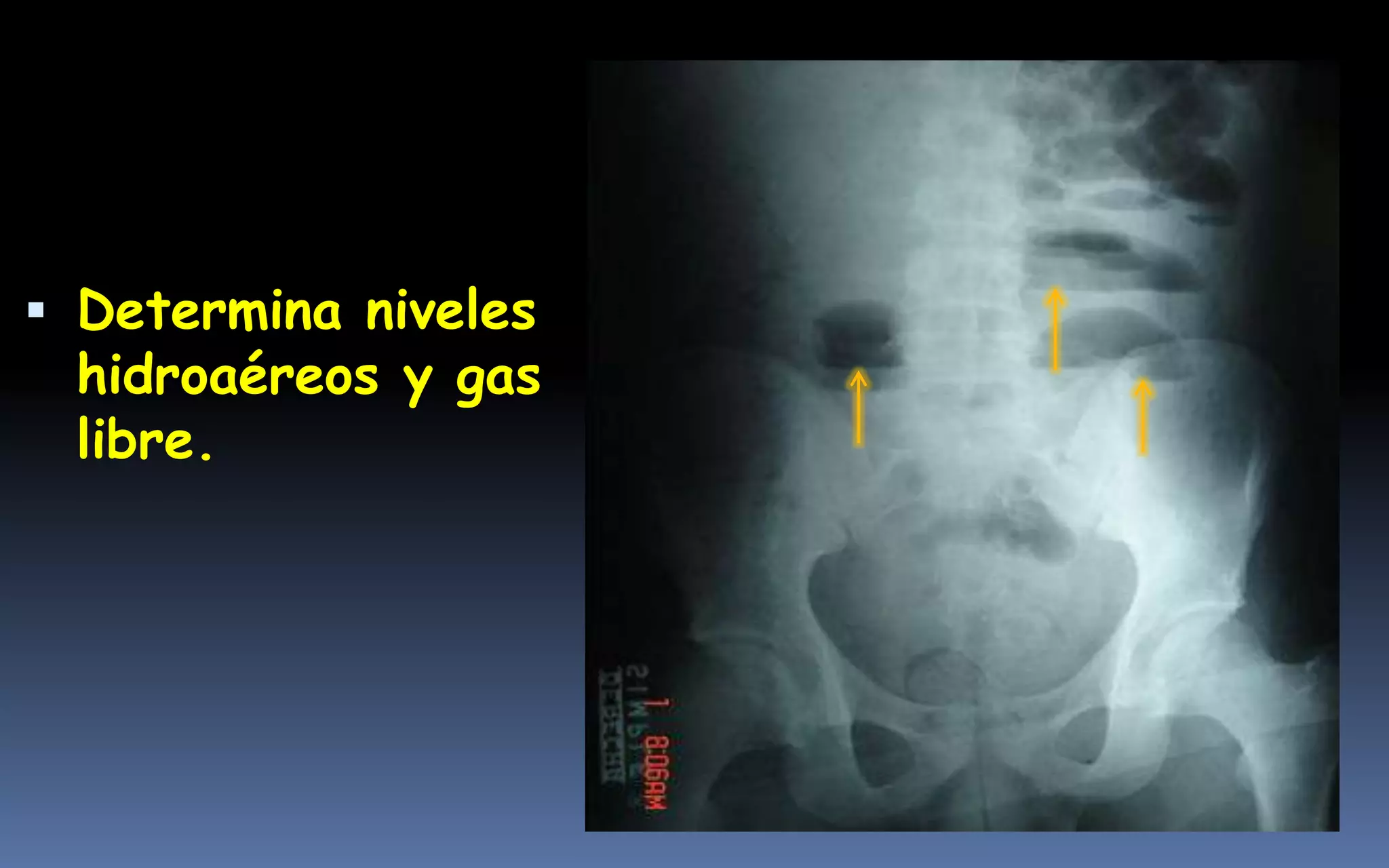 4 Imagenolog a De Abdomen Clase 4-imagenolog-a-de-abdomen-clase