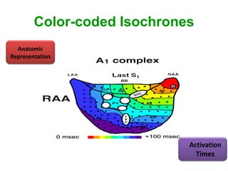 Color-coded Isochrones
  Anatomic
Representation




                             Activation
                               Times
 