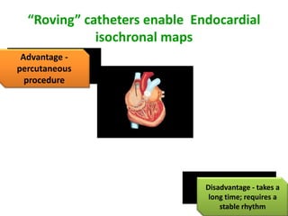 “Roving” catheters enable Endocardial
             isochronal maps
 Advantage -
percutaneous
  procedure




                              Disadvantage - takes a
                               long time; requires a
                                  stable rhythm
 