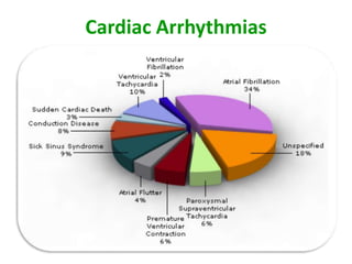Cardiac Arrhythmias
 