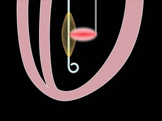 QuickTime™ and a
          H.264 decompressor
     are neede d to see this picture.




24
 