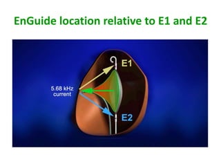 EnGuide location relative to E1 and E2
 