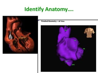 Identify Anatomy….
 