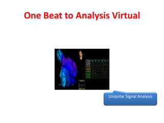 One Beat to Analysis Virtual




                    Unipolar Signal Analysis
 
