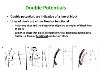 Double Potentials
• Double potentials are indicative of a line of block
• Lines of block are either fixed or functional
   – Atriotomy sites and the Eustachian ridge are examples of fixed lines
     of block
   – Evidence exists that block in region of Cristal terminals during atrial
     flutter is a form of functional conduction block
 