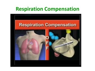 Respiration Compensation
 