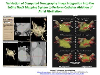 Validation of Computed Tomography Image Integration into the
 EnSite NavX Mapping System to Perform Catheter Ablation of
                      Atrial Fibrillation




                                          Journal of Cardiovascular Electrophysiology
                    Volume 19, Issue 8, pages 821-827, 26 MAR 2008 DOI: 10.1111/j.1540-8167.2008.01127.x
                         http://onlinelibrary.wiley.com/doi/10.1111/j.1540-8167.2008.01127.x/full#f1
 
