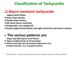 Classification of Tachycardia
 Macro reentrant tachycardia
 typical atrial flutter
lower loop reentry,
double loop reentry,
left atrial macro reentrant
tachycardia, scar-related AT,
reverse typical atrial flutter and right atrial free wall macro reentry


 The various patterns are:
 Single loop (like typical atrial flutter)
 Figure of eight (made up of two loops)
 Reentry through narrow channels adjacent to scar,
 anatomic barriers (i.e. tricuspid annulus)


  (Zipes DP, Jalife J. Cardiac Electrophysiology: From cell to bedside, 4th edition. 2004; pg. 500-501)
 