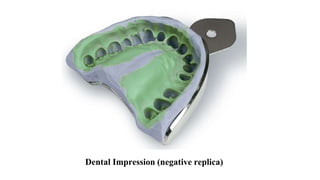 Dental Impression (negative replica)
 