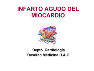 INFARTO AGUDO DEL MIOCARDIO Depto.  Cardiología Facultad Medicina  U.A.G. 