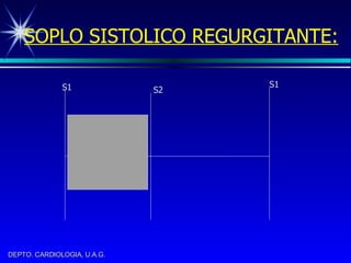 SOPLO SISTOLICO REGURGITANTE: S1 S2 S1 
