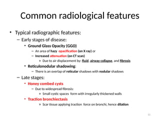 11
Common radiological features
• Typical radiographic features:
– Early stages of disease:
• Ground Glass Opacity (GGO)
– An area of hazy opacification (on X ray) or
– Increased attenuation (on CT scan)
» Due to air displacement by: fluid, airway collapse, and fibrosis
• Reticulonodular shadowing:
– There is an overlap of reticular shadows with nodular shadows
– Late stages:
• Honey combed cysts
– Due to widespread fibrosis:
» Small cystic spaces form with irregularly thickened walls
• Traction bronchiectasis
» Scar tissue applying traction force on bronchi, hence dilation
 