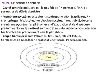 Micro: De dedans en dehors:
- Cavité centrale: occupée par le pus fait de PN normaux, PNA, de
germes et de débris tissulaire
- Membrane pyogène: faite d'un tissu de granulation (capillaires, PN,
macrophages, histiocytes, lymphoplasmocytes, fibroblastes), de cette
membrane pyogène, les phénomènes d'exsudation et de diapédèse
prédominent vers la cavité et sont entretenus du fait de la non détersion
Les fibroblastes prédominent vers la périphérie
- Coque fibreuse: sépare l'abcès du tissu sain, elle est faite de
fibroblastes et de collagène réalisant une fibrose d'encerclement.
 