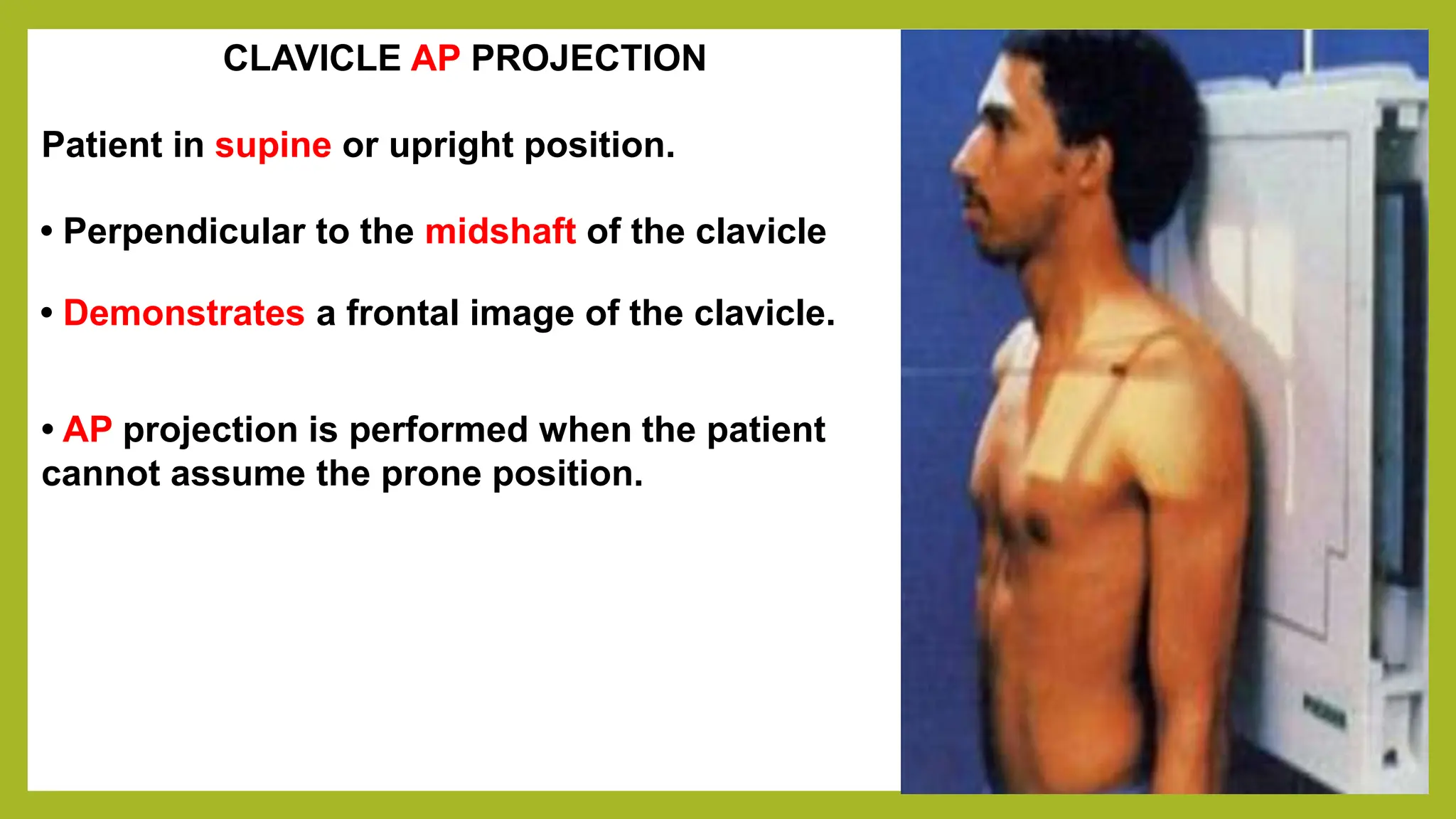 (4-M) 301 - A Shoulder to Clavicle.pptx
