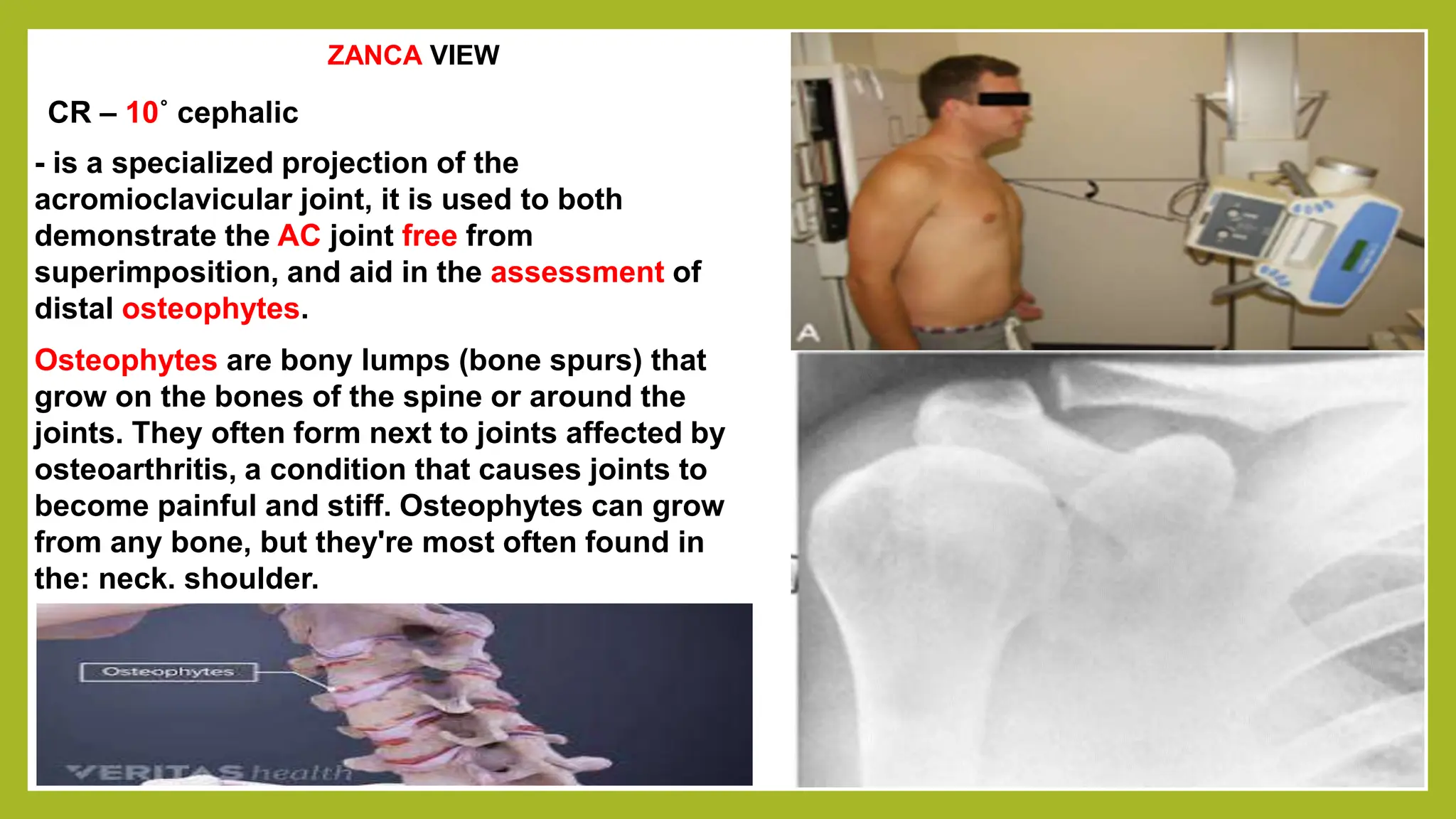 (4-M) 301 - A Shoulder to Clavicle.pptx