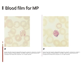 Blood film for MP  