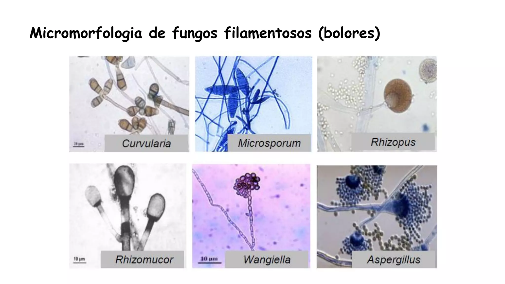 Micromorfologia de fungos filamentosos (bolores)
 