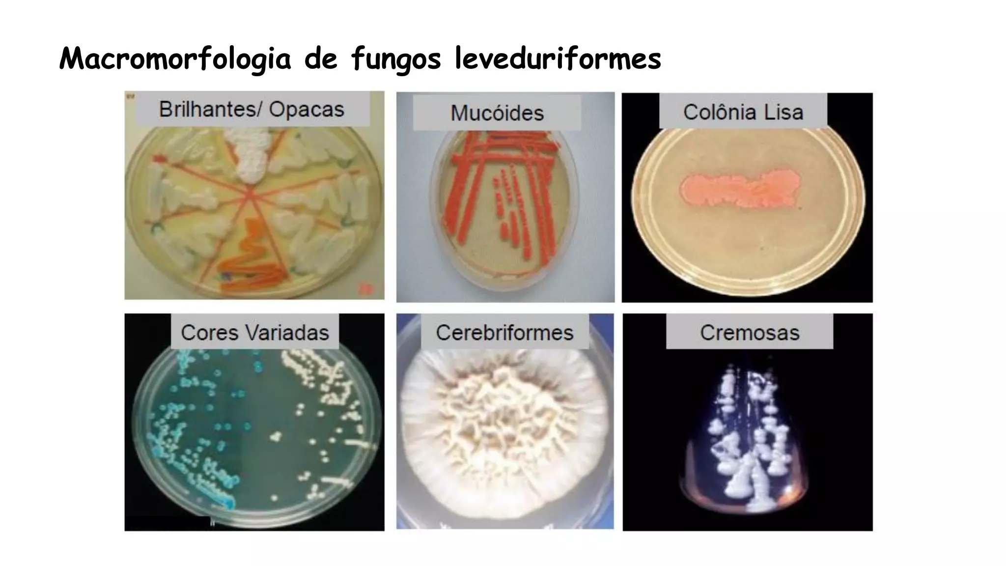 Macromorfologia de fungos leveduriformes
 