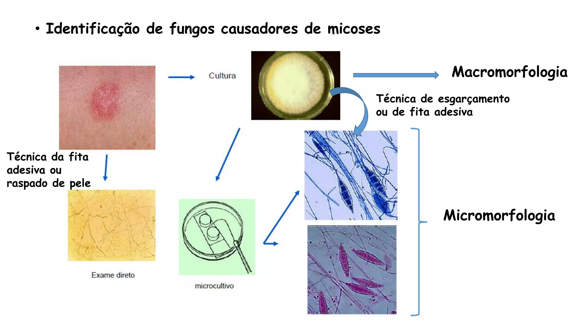 • Identificação de fungos causadores de micoses
Macromorfologia
Micromorfologia
Técnica de esgarçamento
ou de fita adesiva
Técnica da fita
adesiva ou
raspado de pele
 