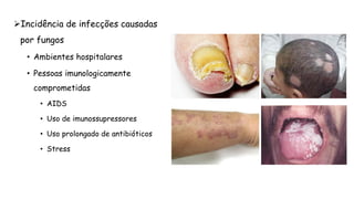 Incidência de infecções causadas
por fungos
• Ambientes hospitalares
• Pessoas imunologicamente
comprometidas
• AIDS
• Uso de imunossupressores
• Uso prolongado de antibióticos
• Stress
 