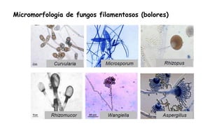 Micromorfologia de fungos filamentosos (bolores)
 