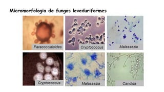 Micromorfologia de fungos leveduriformes
 