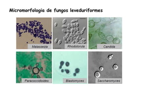 Micromorfologia de fungos leveduriformes
 