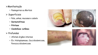 Manifestação
• Passageiras ou Mortais
 Superficiais
• Pele, unhas, mucosas e cabelo
• Dermatofitose
• Pitiríase
• Candidíase cutânea
 Profundas
• Afetam órgãos internos
• Ex. Histoplasmose, Coccidiodomicose,
Paracoccidiodomicose
 